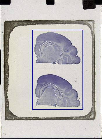 Media type: image; Special Collections 3043   shows specimen_part histological serial section;